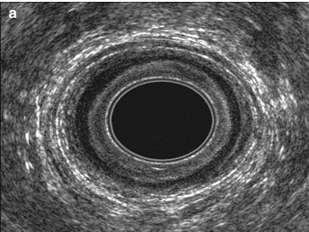 UHNM Pelvic Floor Imaging Workshop